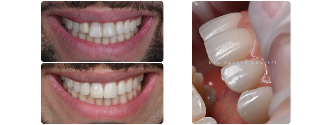 Eindresultaat & Documentatie